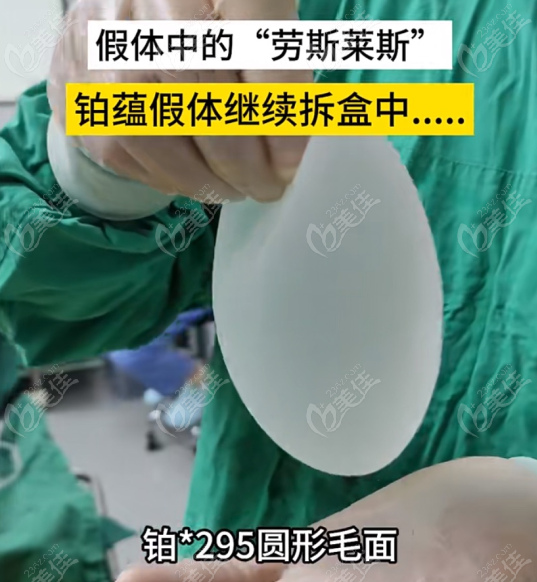 强生曼托铂蕴假体怎么样m.236z.com