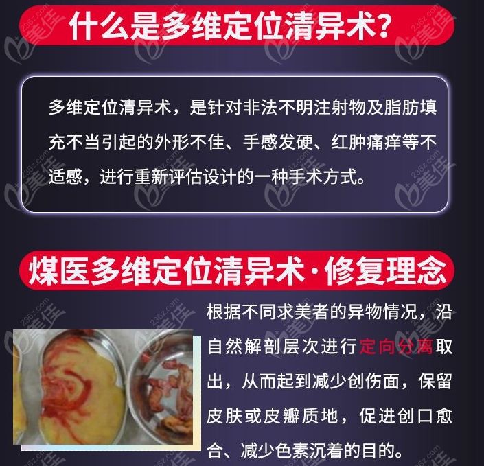 周云超異物取出做得好m.236z.com