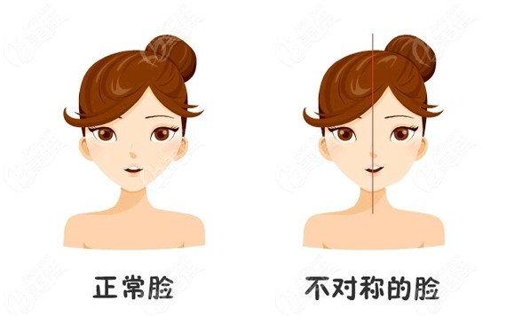 臉型不流暢可能是因為脂肪堆積分布不均