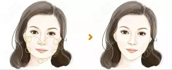 臉型不流暢可能是因為骨骼結構不勻稱等原因