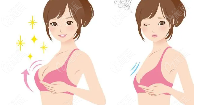 假体隆胸的优势特点www.236z.com