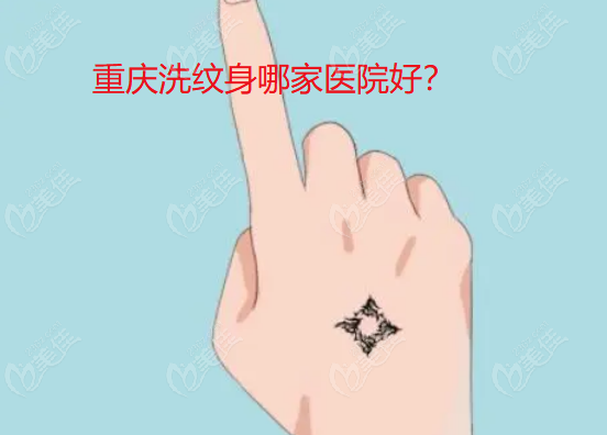 重庆洗纹身哪家医院好top10医院推荐