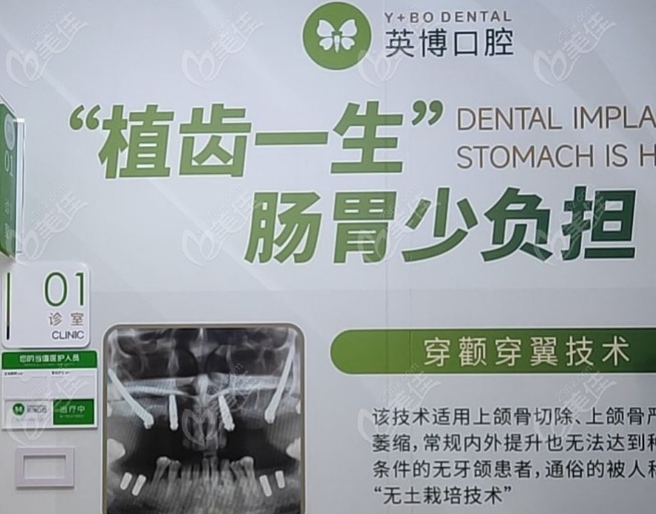上海英博口腔穿颧穿翼种植牙技术