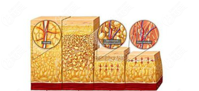 北京<!--<i data=20240703-sp></i>--><!--<i data=20240703-sp></i>-->李广学脂肪修复怎么样(美佳网) 北京<!--<i data=20240703-sp></i>--><!--<i data=20240703-sp></i>-->李广学脂肪修复怎么样(美佳网)