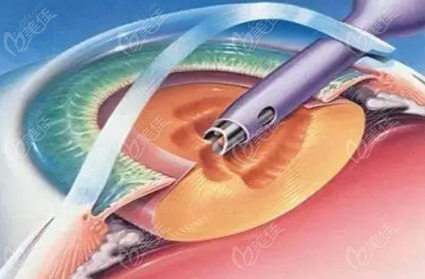 兰州眼科医院排行榜(236z.com) 兰州眼科医院排行榜(236z.com)