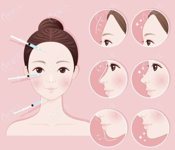 蔣錚錚醫(yī)生擅長領域 美佳