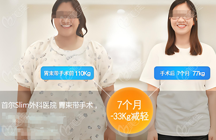韩国首尔SLIM外科医院成功实例