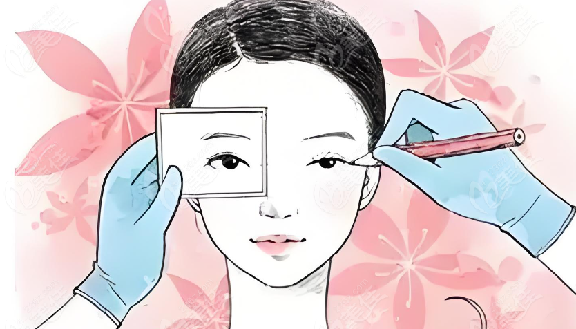 杭州眼修复医生排行榜前十