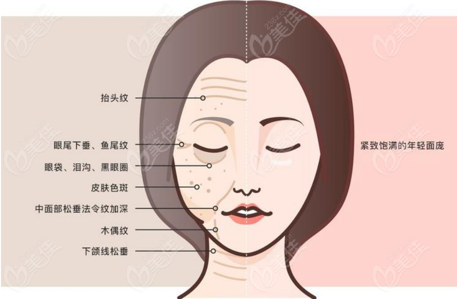 236z.com面部拉皮手術