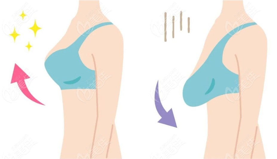 有乳腺增生可以做缩胸手术！