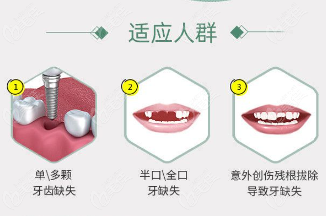 荊州種植牙哪家劃算