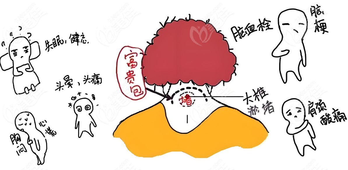 曹孟君富貴包真實(shí)感受