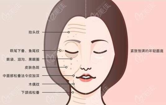 杜太超拉皮价格不贵没有翻车实例