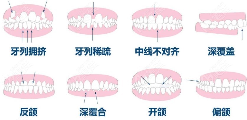 北京维乐口腔矫正牙齿价目表