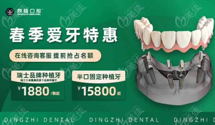 上海鼎植口腔种植牙收费价格