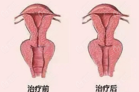 北京嘉禾和北京協和做3D生物束帶價格