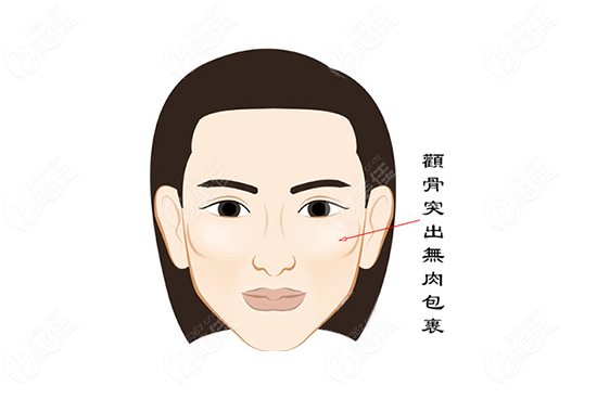 黃大勇磨骨會掛不住肉嗎？