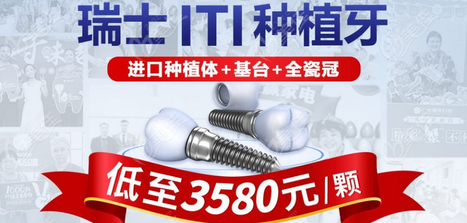 <!--<i data=20240703-sp></i>-->申潔口腔醫院種植牙活動價格