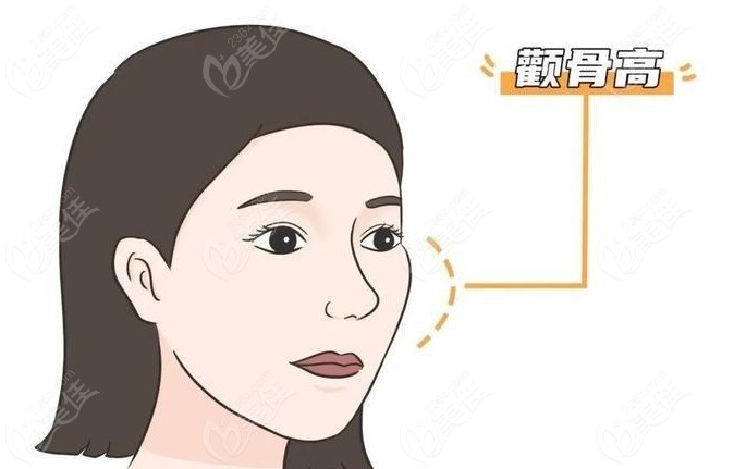 国内磨骨医生前3名做颧骨内推下颌角磨骨好