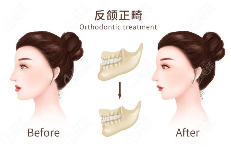 上海曹栋弼颌面手术