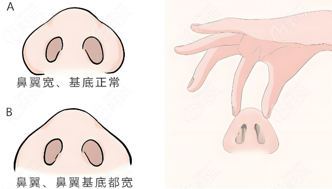 刘中策医生做鼻子技术怎么样？