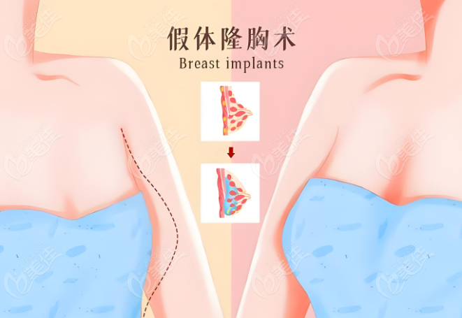 刘中策医生坐诊医院+预约挂号www.236z.com