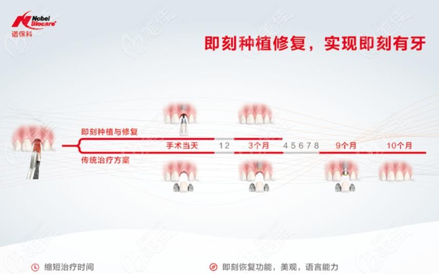 即刻种植牙修复方案236z.com