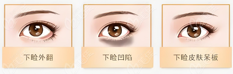 鄭州王楊修復眼袋靠譜