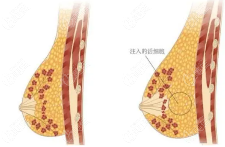 汇总10个北京八大处丰胸好的医生名单