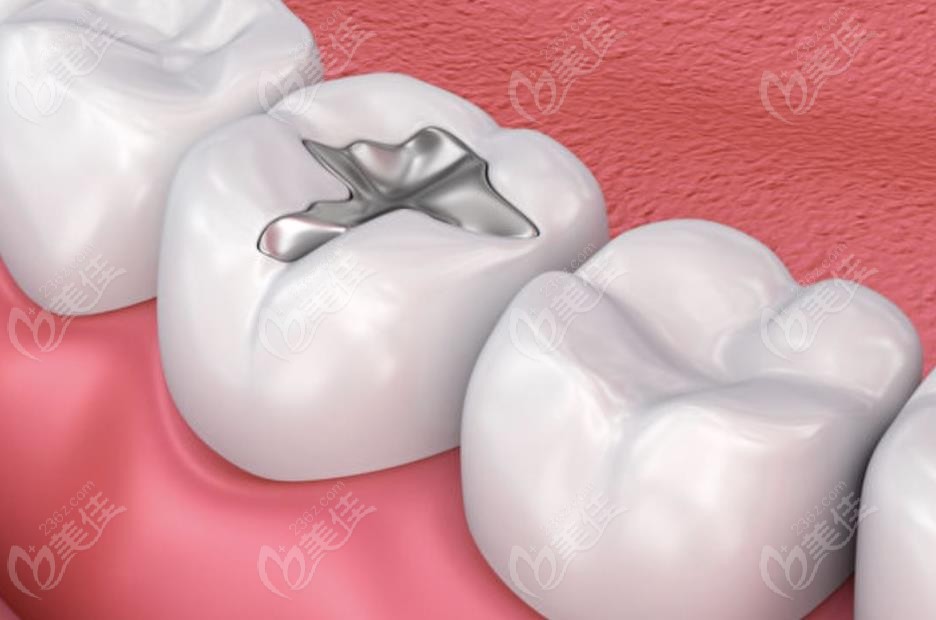 南昌德韓口腔醫(yī)院補(bǔ)牙價格表