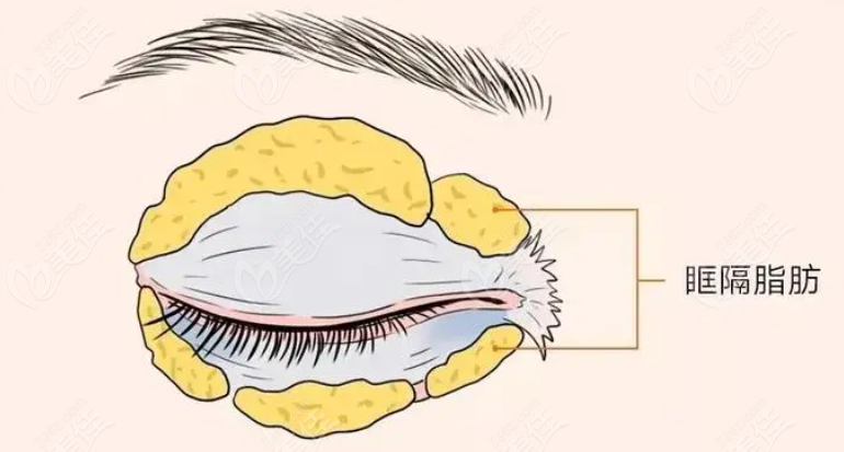 薛瑞醫(yī)生做眼睛怎么樣？