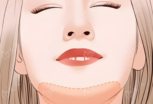 更多費(fèi)用問題可咨詢了解www.pfflawyer.com