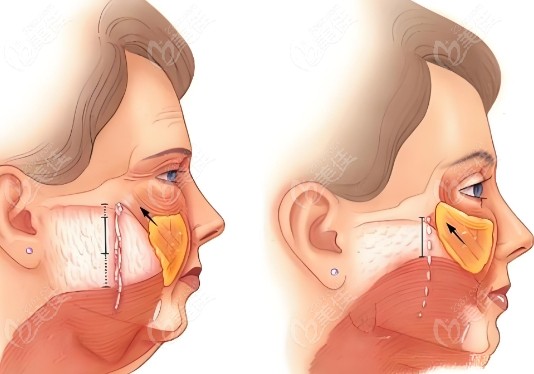 青島<!--<i data=20240703-sp></i>--><!--<i data=20240703-sp></i>-->醫(yī)院醫(yī)美美容科項(xiàng)目收費(fèi)價(jià)格
