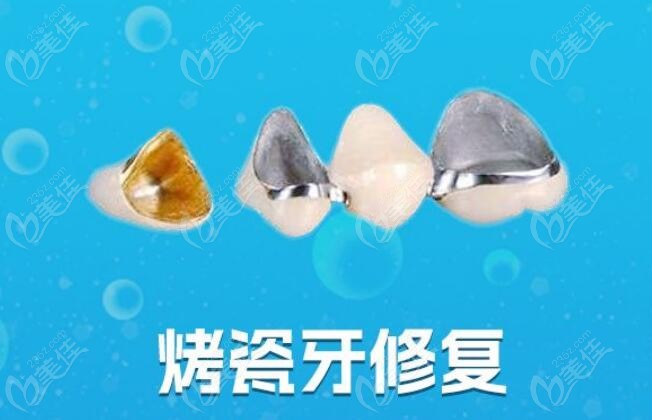 烤瓷牙修复