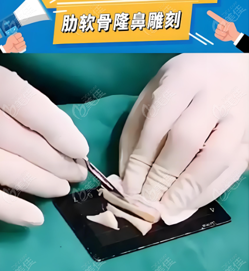 <!--<i data=20240703-sp></i>-->鼻子实例分享