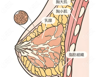 杭州栗勇医生做缩胸手术中度是多长乳房？