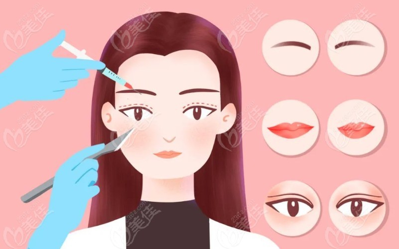 师丽丽双眼皮修复技术好