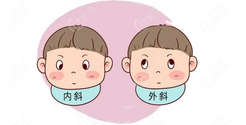 中山大学中山眼科医院小儿斜视手术费用