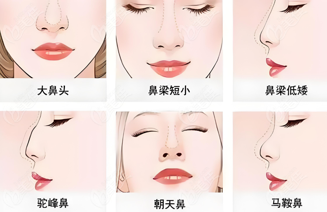 <!--<i data=20240703-sp></i>-->娜美整形<!--<i data=20240703-sp></i>-->简介
