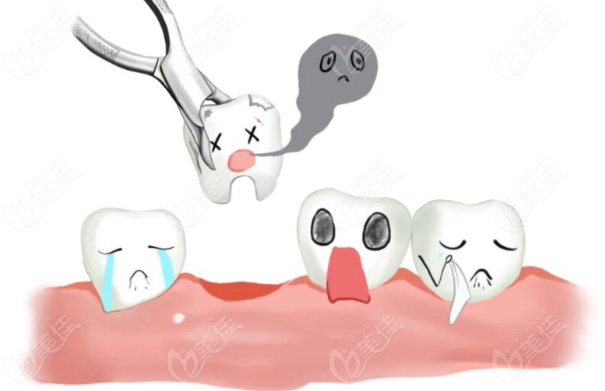 北京中诺口腔医院拔牙拔牙多少钱 北京中诺口腔医院拔牙拔牙多少钱