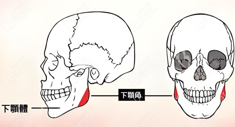 余东整形医生磨骨口碑反馈