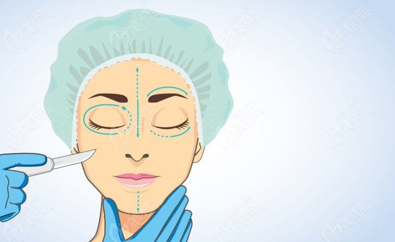 <!--<i data=20240703-sp></i>-->杜园园修复双眼皮怎么收费？