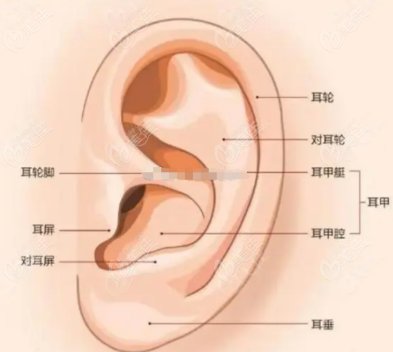 耳再造手术示意图