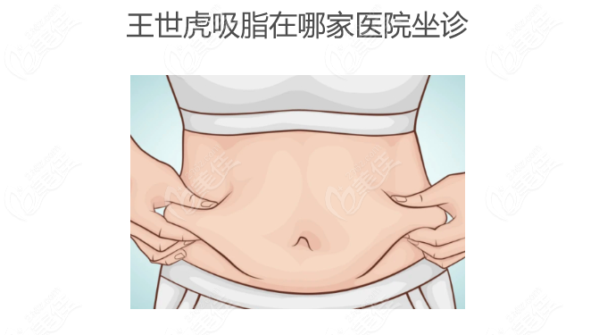 王世虎吸脂在哪家醫(yī)院坐診