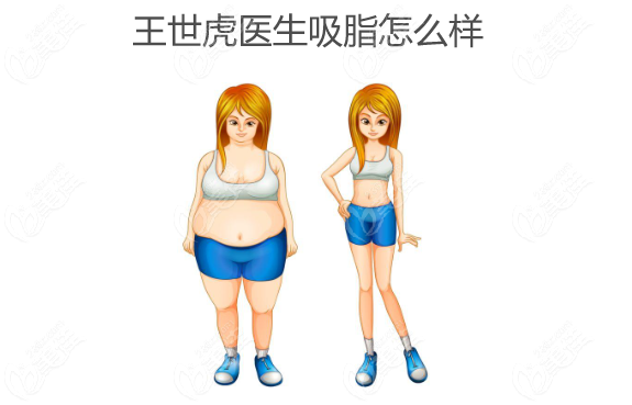 王世虎醫(yī)生吸脂怎么樣