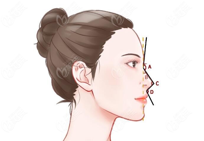 隆鼻的标准弧度236z.com