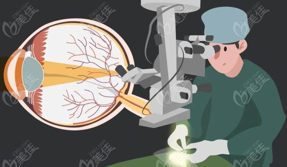 眼球震颤手术对医生要求技术高