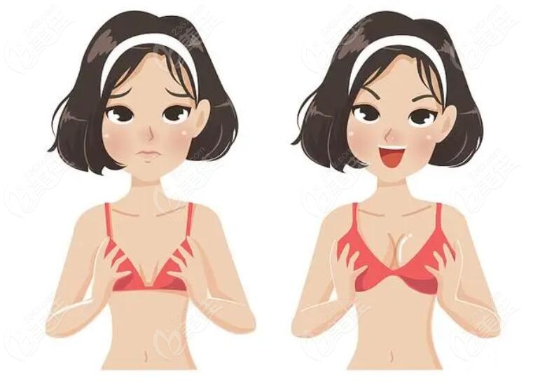 想做隆胸的市民看过来236z.com