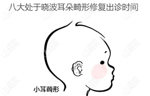 八大处于晓波耳朵畸形修复出诊时间www.236z.com