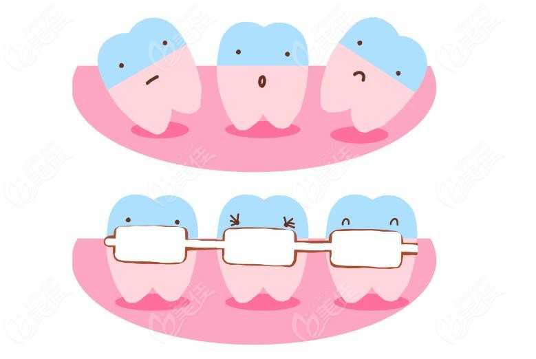 牙齿治疗卡通图236z.com